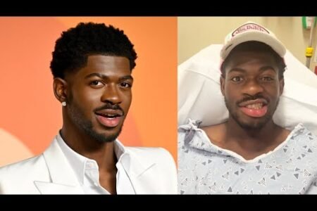 Lil Nas X Hospitalized for Partial Facial Paralysis
