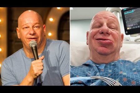 Comedian Jeff Ross Shares Shocking Results From Allergic Reaction to Ice Cream