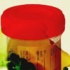 Thousands of Urine and Tissue Samples Are in Danger of Rotting After Staff Cuts at a CDC Laboratory